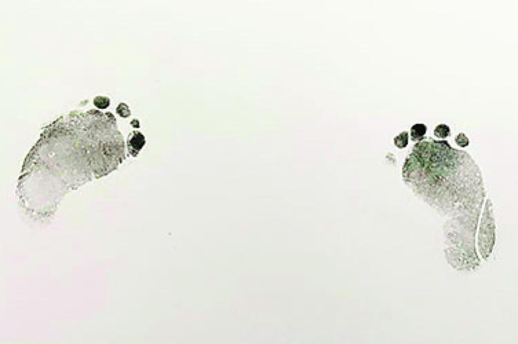 Alt Text for Image